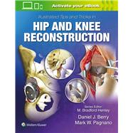 Illustrated Tips and Tricks in Hip and Knee Reconstructive and Replacement Surgery