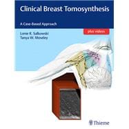 Clinical Breast Tomosynthesis