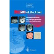MRI of the Liver : Imaging Techniques, Contrast Enhancement, Differential Diagnosis