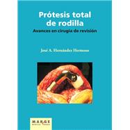 Avances en cirugía de revisión de la prótesis total de rodilla