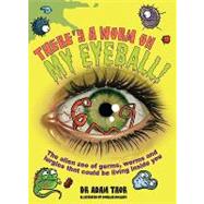 There's a Worm on My Eyeball