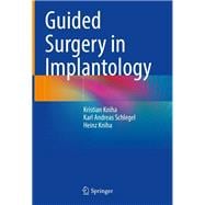 Guided Surgery in Implantology
