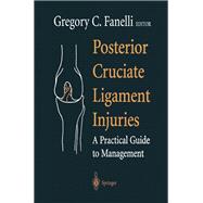 Posterior Cruciate Ligament Injuries