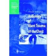 Radiology of Blunt Trauma of the Chest