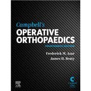 Campbell's Operative Orthopaedics, E-Book