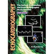 Echocardiography