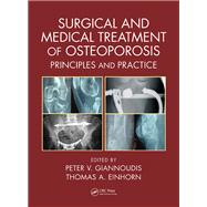 Surgical and Medical Treatment of Osteoporosis: Principles and Practice