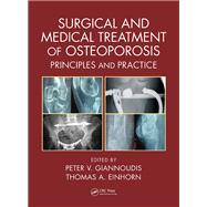 Surgical and Medical Treatment of Osteoporosis