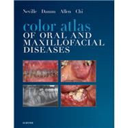 Color Atlas of Oral and Maxillofacial Diseases