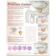 Understanding Prostate Cancer Anatomical Chart