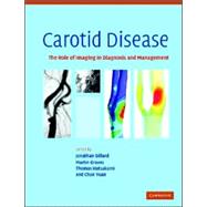 Carotid Disease: The Role of Imaging in Diagnosis and Management