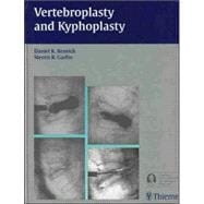 Vertebroplasty And Kyphoplasty,9781588902276