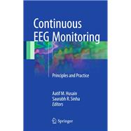 Continuous Eeg Monitoring