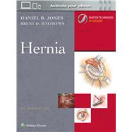Master Techniques in Surgery: Hernia: Print + eBook with Multimedia