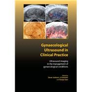 Gynaecological Ultrasound in Clinical Practice
