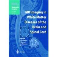 Mr Imaging In White Matter Diseases Of The Brain And Spinal Cord