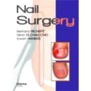 Nail Surgery