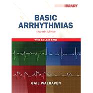 Basic Arrhythmias