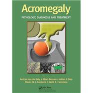 Acromegaly