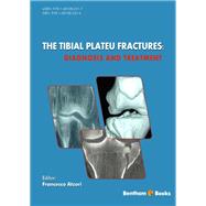 The Tibial Plateau Fractures: Diagnosis and Treatment