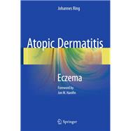 Atopic Dermatitis