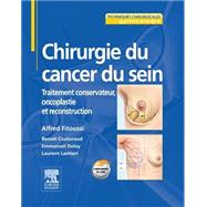 Chirurgie du cancer du sein