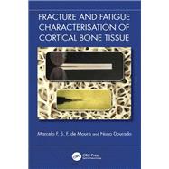 Fracture and Fatigue Characterisation of Cortical Bone Tissue