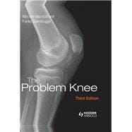 The Problem Knee