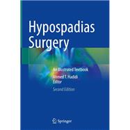 Hypospadias Surgery