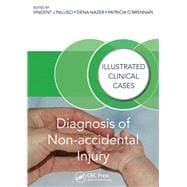 Diagnosis of Non-accidental Injury