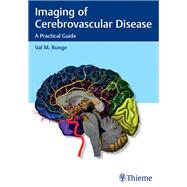 Imaging of Cerebrovascular Disease