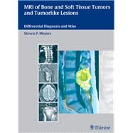 MRI of Bone and Soft Tissue Tumors and Tumorlike Lesions: Differential Diagnosis and Atlas