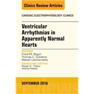 Ventricular Arrhythmias in Apparently Normal Hearts