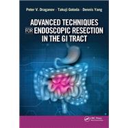 Advanced Techniques for Endoscopic Resection in the GI Tract