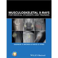 Musculoskeletal X-Rays for Medical Students and Trainees