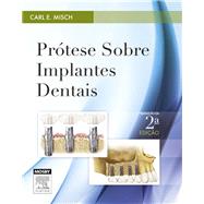 Prótese sobre Implantes Dentais
