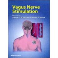 Vagus Nerve Stimulation, Second Edition
