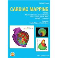Cardiac Mapping