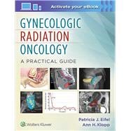 Gynecologic Radiation Oncology: A Practical Guide