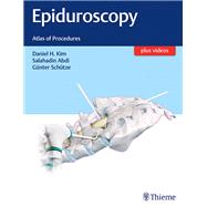 Epiduroscopy
