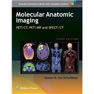 Molecular Anatomic Imaging PET/CT, PET/MR and SPECT CT