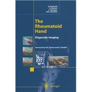 The Rheumatoid Hand
