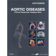 Aortic Diseases (Book with Web Access and DVD)