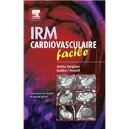 IRM cardiovasculaire facile
