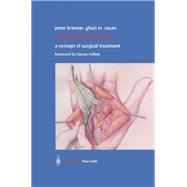 Dupuytren’s Disease