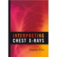 Interpreting Chest X-rays