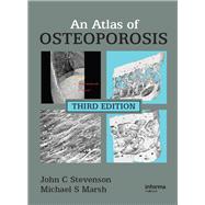 An Atlas of Osteoporosis