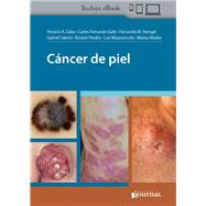 Cáncer de piel