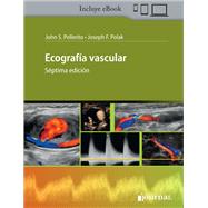 Ecografía vascular
