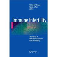 Immune Infertility